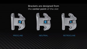 26K views · 26 reactions | Enhance torque control with retrocline and procline bracket options. With the Damon Ultima™ System, brackets are designed for center-point slot alignment at the FA point for desired torque expression and easier, more precise bracket placement. Learn more at ormco.com/ultima #Ormco #DamonUltimaSystem | Ormco | Facebook