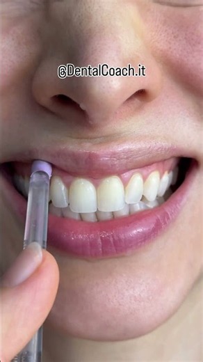 How to use water flosser correctly ⁉️ #tooth #dentist #waterflosser #cleaning #viral