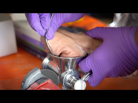 Man VS Machine | Meat Grinder Accident | Disentanglement