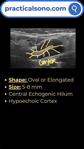 Normal Lymph Node Ultrasound #ultrasonography #lymphnodes