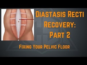 Diastasis Recti Recovery Part 2: Fixing Your Pelvic Floor