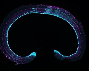 PAINT-ing the future of fluorescence imaging
