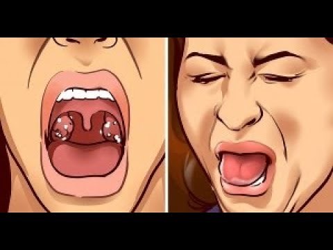 9 Things a Bad Taste in Your Mouth Is Trying to Tell You