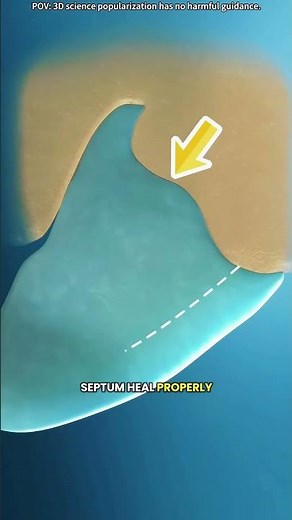 Deviated nasal septum (3D animation)