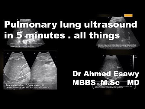 LUNG ULTRASOUND IN 5 MINUTES ALL THINGS