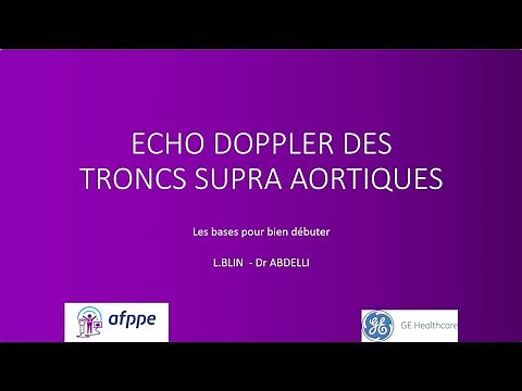 Échographie Doppler des Troncs Supra Aortique : les bases pour bien débuter (manip to manip)