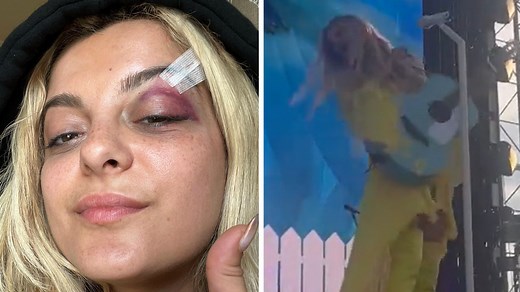 11 Musicians Who Suffered Scary On Stage Injuries