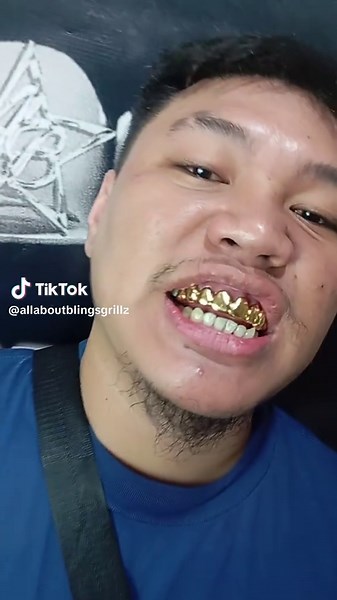 Custom Gold Grillz for Gleaming Smiles