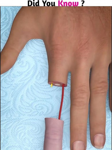 Can you reattach a severed finger 🤞🏼 ( 3D Animation ) #shorts