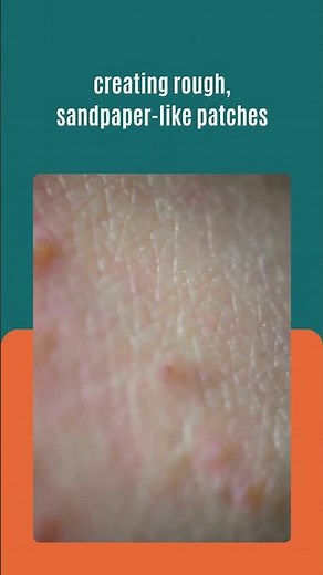 Red Dots On Skin | Small Red Dots On Skin | Red Rashes On Skin