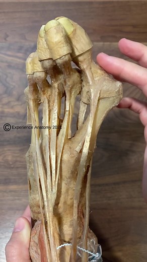 Bunion anatomy! #anatomy #bunion #anatomylesson #anatomylab #plastination