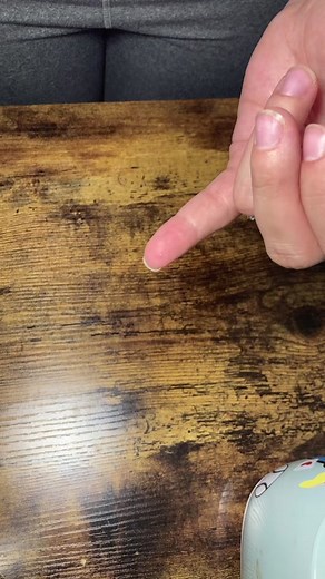 Sliver/Splinter removal video 👏🏼👏🏼 #sliverremoval #splinterremoval #10MillionAdoptions￼ #FrunktheBeat￼ #ttimecreations #fyp #hacks #parentsoftiktok #parenthacks #hacksoflife #hack101