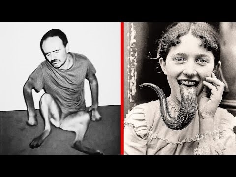 15 Circus Freaks Who Challenged Society