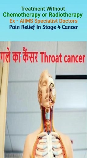 1.7K views · 35 reactions | What are the reasons of throat cancer ?...
