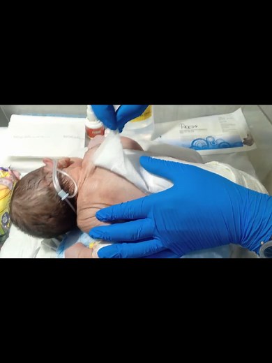 A tiny life going through healing and care 💛 Every newborn deserves love, care, and support. 👉 Add: Educational purpose only#trending #fyp #foryou #foryoupage #viralvideo #trending #explorepage #tiktokusa #usaviral #viralreels #trendingshorts #usa #american #usaaudience #usavideos #usatrending #viralusa #usashorts #contentusa #growusa #audienceusa #newbornbaby #newborn #babymoments #babyvideo #cutebaby #babylove #babyviral #babylife #babytrend #babyreels #nicu #nicubaby #nicuawareness #niculif