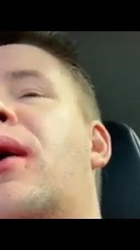 Wisdom Teeth Removal: Hilarious Anesthesia Aftermath || WooGlobe