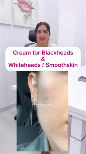 Cerave Face Wash Review: Is It Right for You?