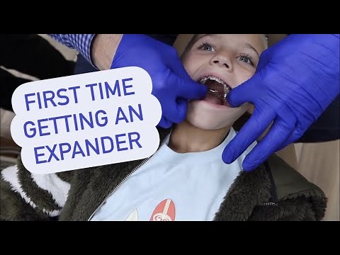 Perri’s Braces Adjusted And Starts Tumbling | The LeRoys