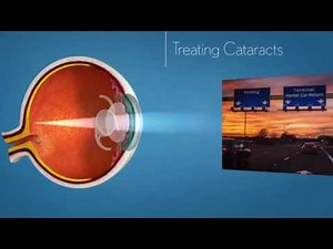 Crystalens IOL Introduction