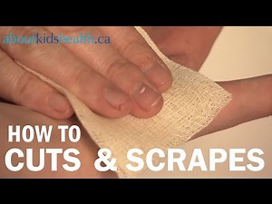 How to treat cuts and scrapes / Comment traiter les coupures et les éraflures | SickKids