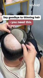 Different bases, different preferences. What’s your favorite hair system base? I’ll go first: skin base 🙌 👉 Learn More:https://bit.ly/LavividHair #MensHair #menstoupee #HairSystem #LaVividHair #menshairsystem #HairConfidence #MensHairSystem | LaVivid Hair System