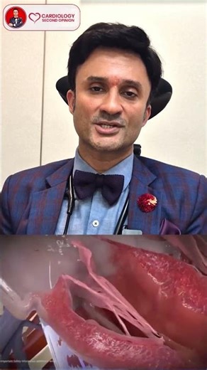 Who Should Get a MitraClip? Best Candidates Explained | Dr. Amit Bhushan Sharma