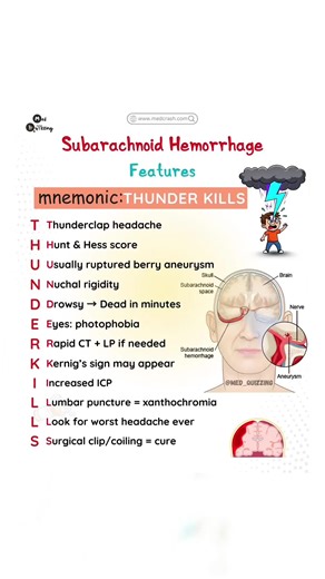 Unlock Your Study Potential with Mnemonic Flashcards