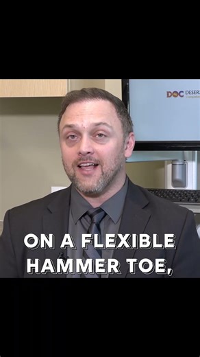 What Is a Tenotomy? | Hammer Toe Treatment Explained Simply