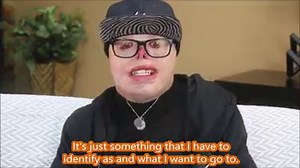 2M views · 54K reactions | Jadiant miraculously survived severe burns and was put into a medically induced coma. Months later he awoke to a new reality in which other children called him a “monster” while throwing rocks at him. After years of struggle, Jadiant has now learned to love himself. | Special Books by Special Kids | Facebook