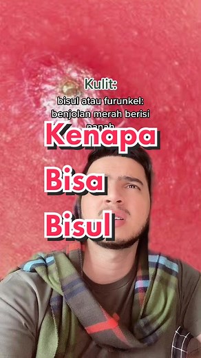 Panduan Bisul: Penyebab, Tanda, dan Cara Mengatasinya