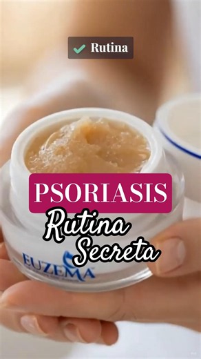 PSORIASIS: Mi Rutina Completa para Cuidar mi Piel Todos los Días