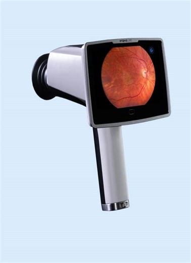 We are excited to share that Optomed Lumo is now approved for integration with Aireen AI algorithm for diabetic retinopathy screening in the EU market. This combined solution brings AI-powered DR screening directly to the point of care, supporting primary care, ophthalmology practices, mobile screening programs, and healthcare systems alike. The result? Earlier detection, broader access, and reduced pressure on specialist services. Interested in seeing it in action? 👉 Contact us to book a demo.