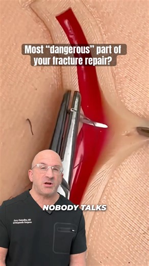 This One Stitch Cuts Complications in Half #medical #technique