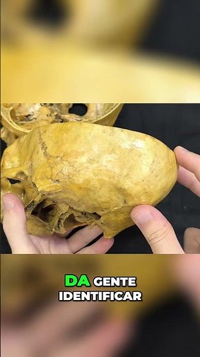 Anatomy of the Skull
