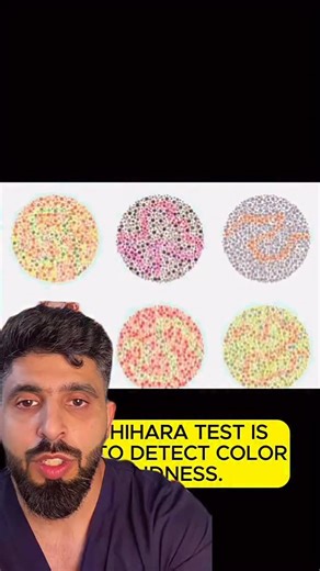 Dr Ashish Markan on Instagram: "Color vision testing ☝️"