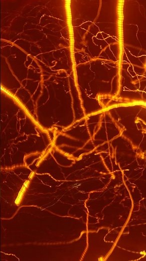 Why does static electricity make your hair stand up?