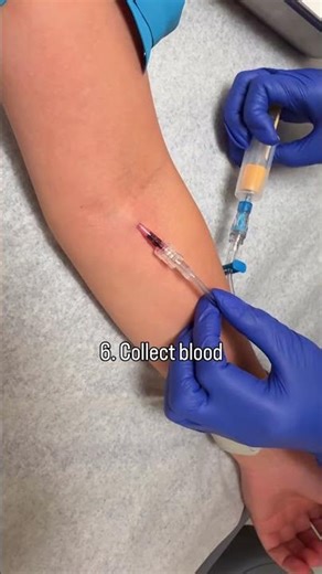 Can I do your IV? #nurseryrhymes #healthandwellness #veins #nursing #students