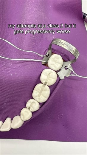 Isha | Dental Student🦷 on Instagram: "sim lab can be humbling inspired by @toothfullyselin #dentalstudent #dentalschool #simlab #dentistry #nyucd"