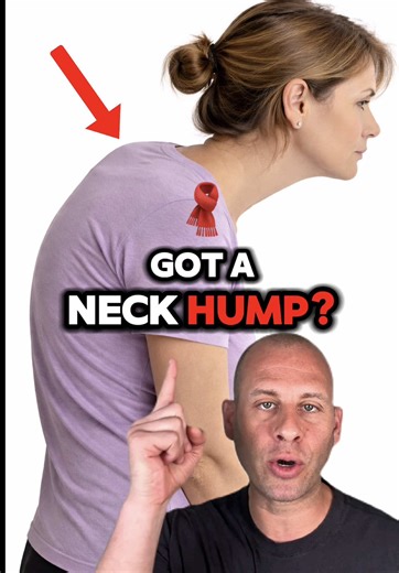 Dealing with a neck hump and not sure what to do about it? First — you’re not the only one. And second — it’s absolutely something you can improve. Over the years as a Posture Therapist, I’ve worked with thousands of people to correct forward head posture, reduce that bump at the base of the neck, and rebuild strong, aligned posture. When your head drifts forward and your shoulders round, the natural curve of your cervical spine changes. Over time, that stress shows up as the “hump” you see and 