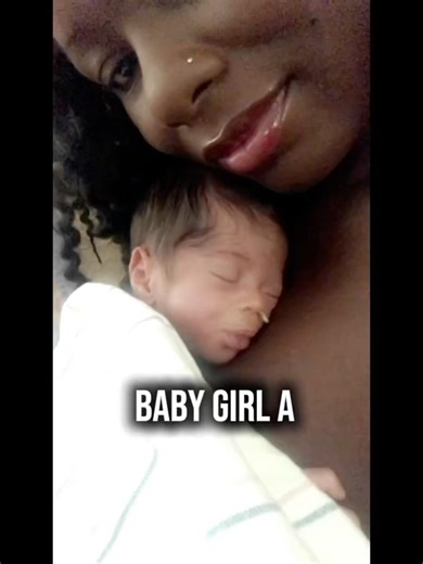 She was only 2 pounds🤍 #nicutonow #baby #transformation