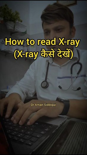 How to read Chest Xray #xray #xrays #chest #medical #radiologist #radiology #aiims #medical #anatomy