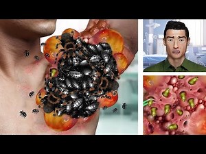 ASMR Doctor Roleplay Animation 😴 Deep Sleep in Minutes