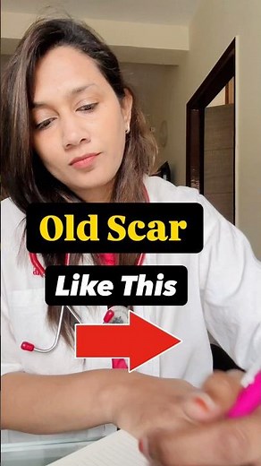 Old Scars Not Fading? 😱 Stop Wasting Money ❌ | Dermatologist Reveals What Actually Works