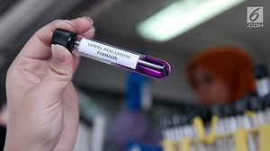 Ciri Makanan Mengandung Formalin, Berbahaya Bagi Kesehatan