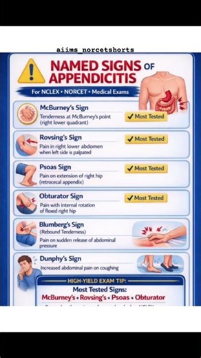 Appendicitis ke Named Signs 🚨 Most Tested in Exams! | NCLEX • NORCET High Yield 💯