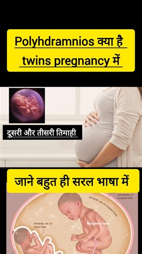 👆full video यहां से देखे Twin Pregnancy मे Polyhydramnios क्या है 🤰(जुड़वा गर्भावस्था और ज्यादा पानी)