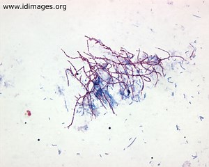 Nocardia - Alchetron, The Free Social Encyclopedia