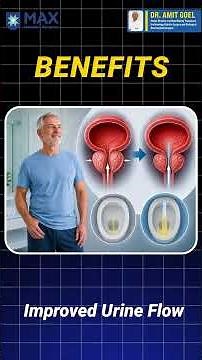 Water Vapour Therapy for Benign Prostate Enlargement: Minimally Invasive Procedure REZUM |