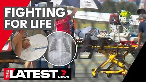 A one-year-old girl is in serious condition in hospital tonight after swallowing a button battery. It’s looking like a long road of recovery ahead, Garth Burley joins us from Brisbane. www.7NEWS.com.au #7NEWS | 7NEWS Australia
