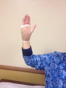Helpful Tips for Post-Operative Elbow, Hand and Shoulder Surgery